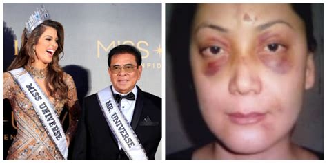 CHR willing to probe Chavit for 'mauling' wife .